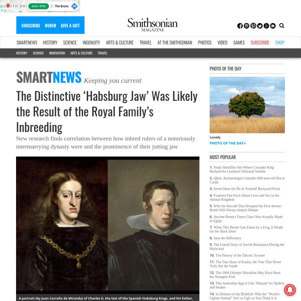 Habsburg Jaw- A Result Of Inbreeding?